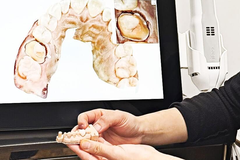 cosmetic_dentistry_5_dental_crowns_image