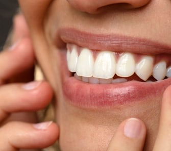 Dental Crowns in Melbourne