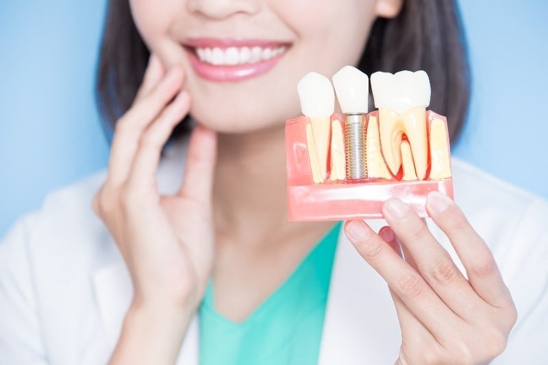 dental_implants_after_care_image