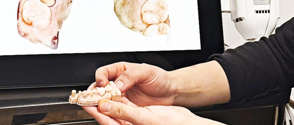 img_feature_dental_crowns