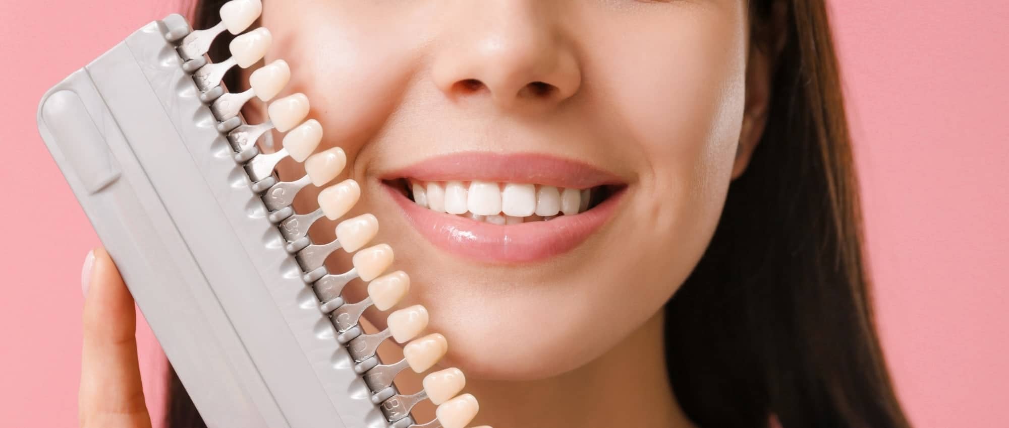 dental veneers melbourne
