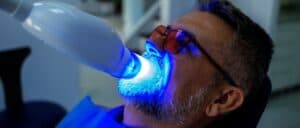 teeth whitening melbourne