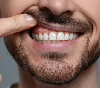 img_feature_periodontal_care