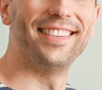 dental veneers melbourne