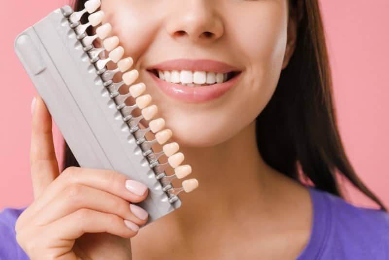dental veneers melbourne