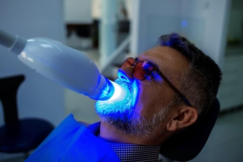 img_feature_teeth_whitening