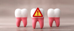 img_feature_How-to-Treat-Gum-Disease