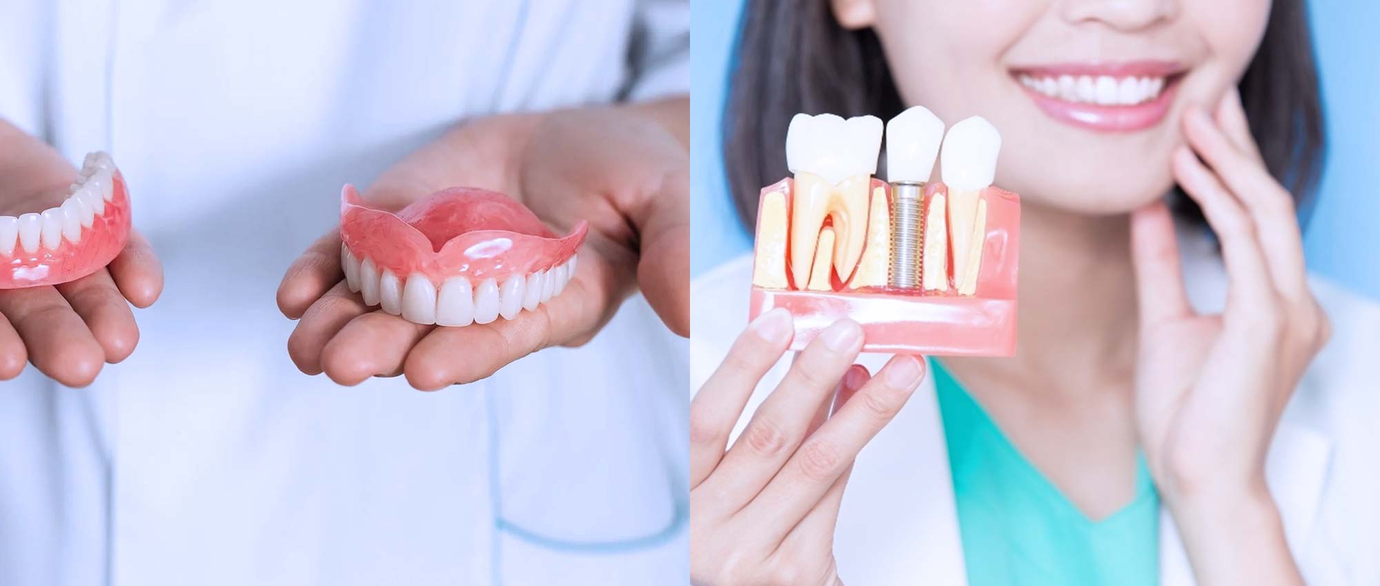 img_feature_Dental-Implants-vs-Dentures