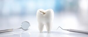 img_feature_Chipped-Tooth-V2
